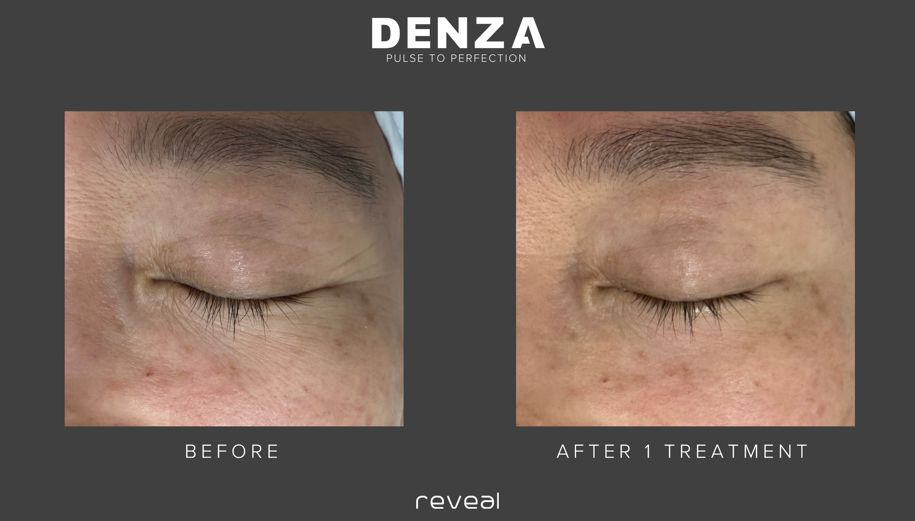 Before and After Images