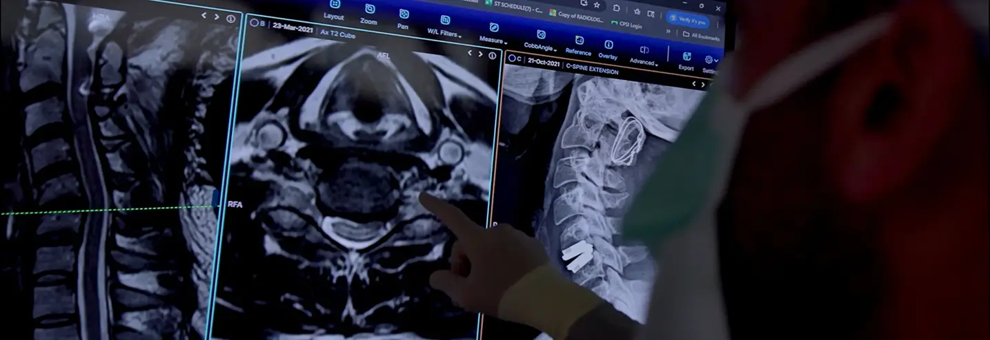 Dr. Yashar reviewing MRI for neurosurgery spine and brain surgery in Los Angeles CA