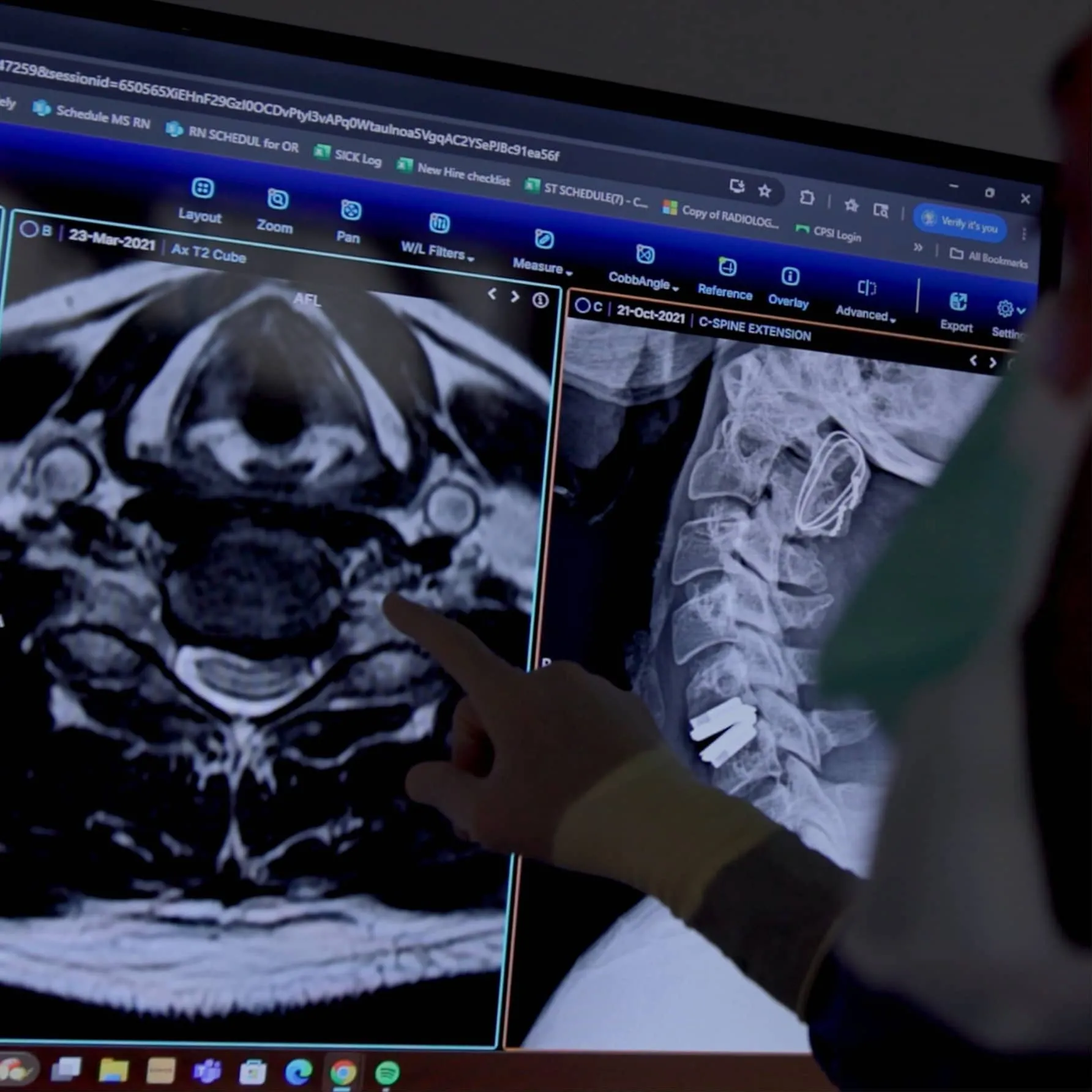Dr._Yashar_reviewing_MRI_for_neurosurgery_spine_and_brain_surgery_in_Los_Angeles_CA