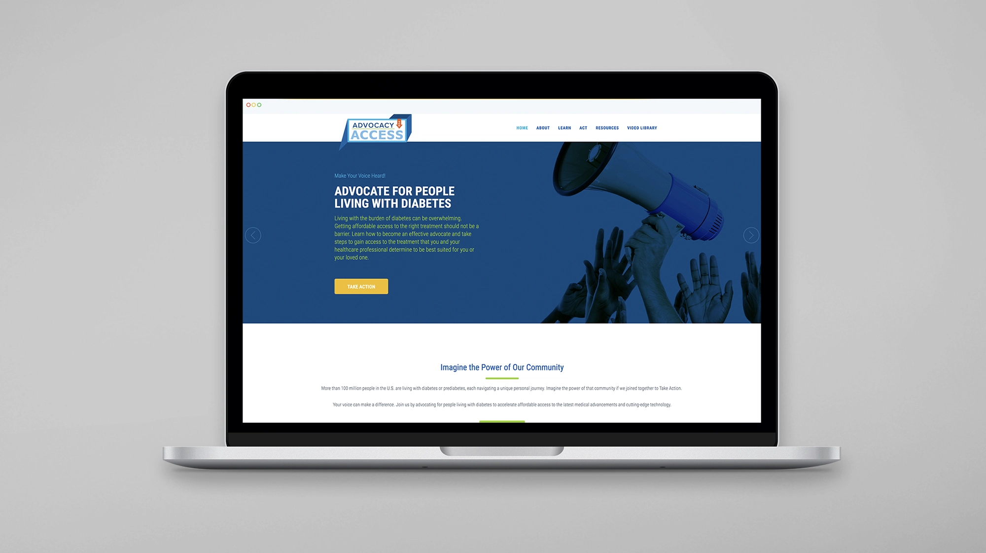 Advocacy for Access