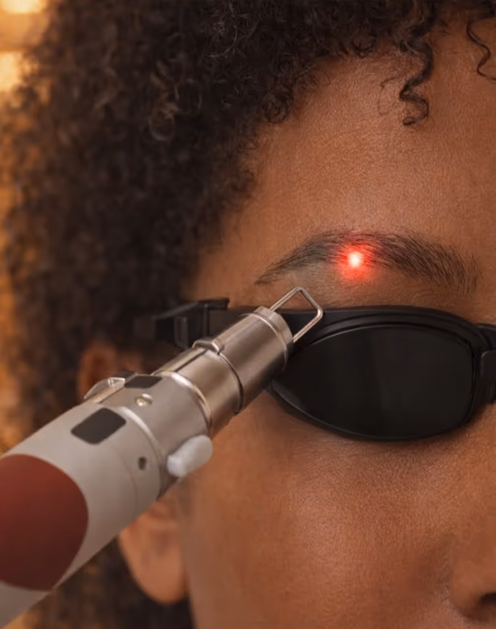 Close-up of a person wearing protective black glasses using a laser device on their eyebrow.