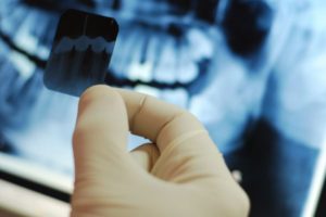 Dental Procedures