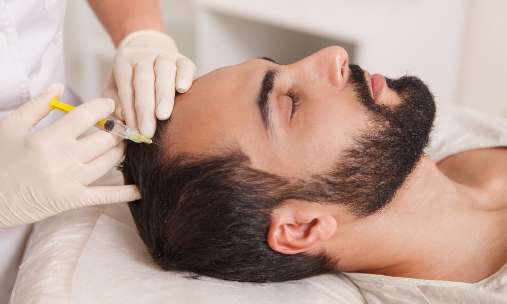 Androgenic Alopecia