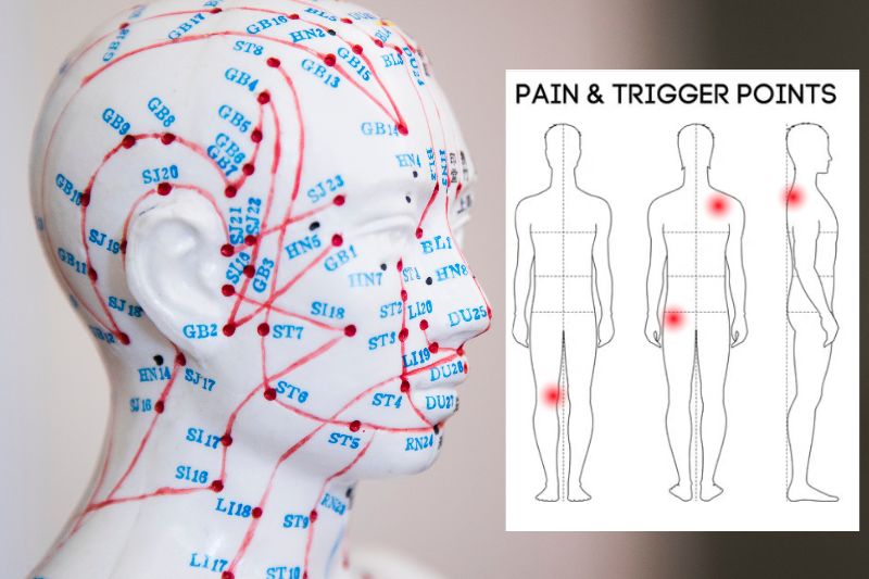 Trigger Points Therapy