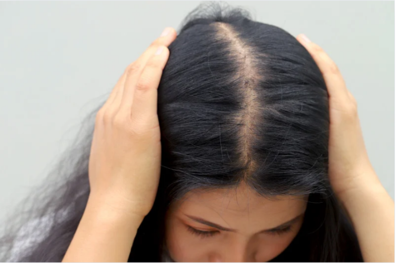 Hair Loss Doctor in Encinitas: Why Patients Trust Dr. Matti for Regrowth Support