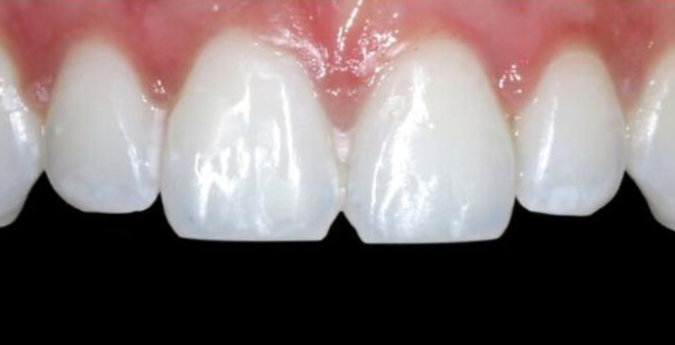 Composite-7