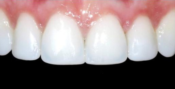 Composite-7