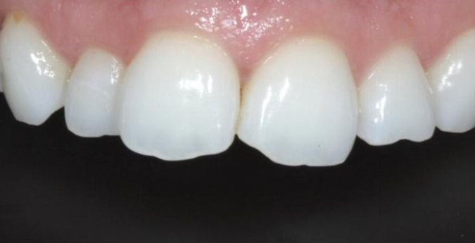 Composite-9