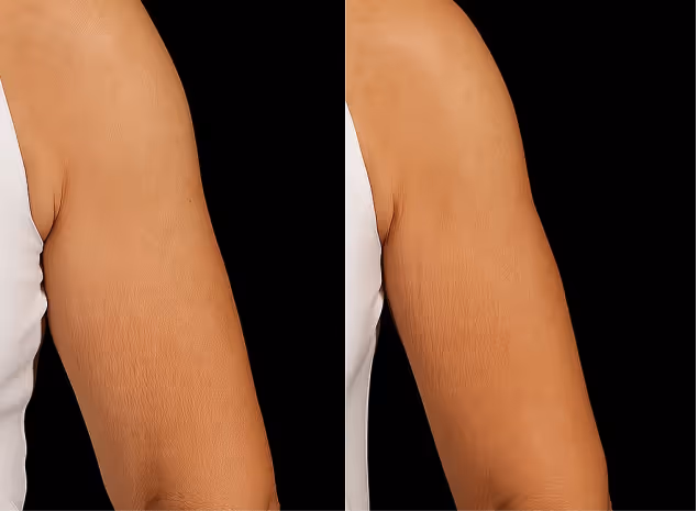 Personalized beauty treatment results, showcasing improved skin tone and texture at Natural Beauty by Helen in Twickenham, UK.