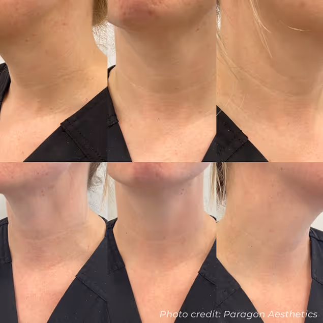 Transform your beauty with personalized skin, facials, and holistic therapies at Natural Beauty by Helen in Twickenham.