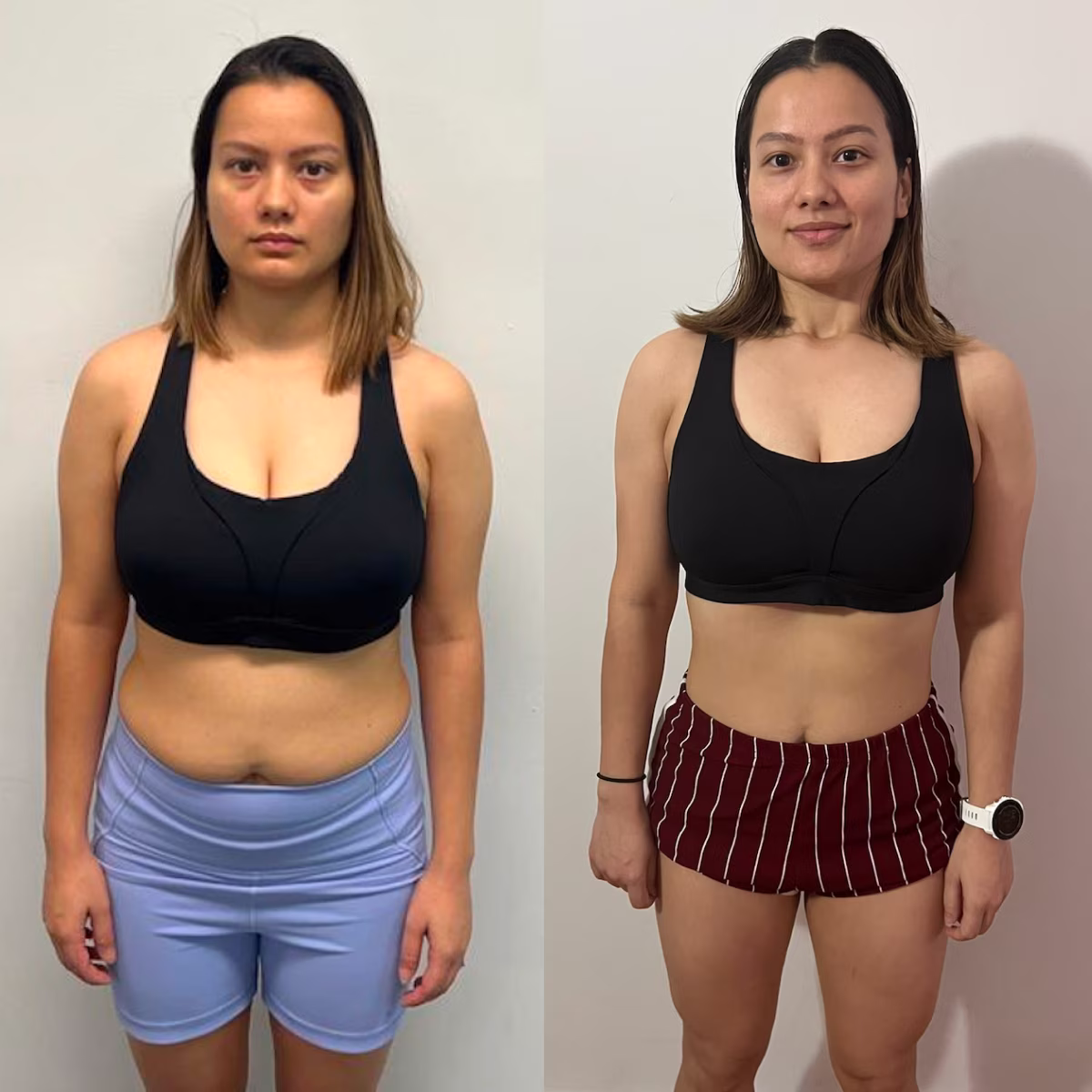 Before and after photo of woman