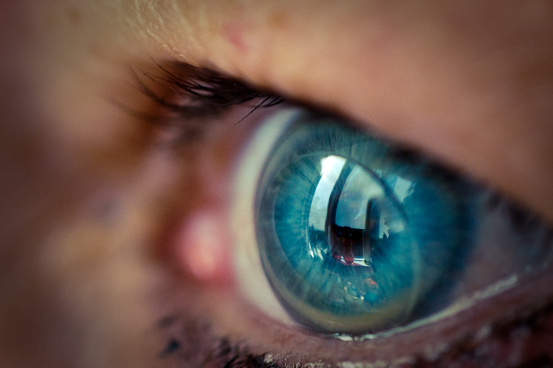 CDC survey shows many contact lens wearers report risky eye care behaviors