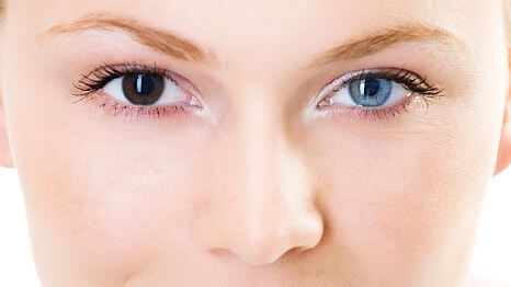 Heterochromia: Causes And Types