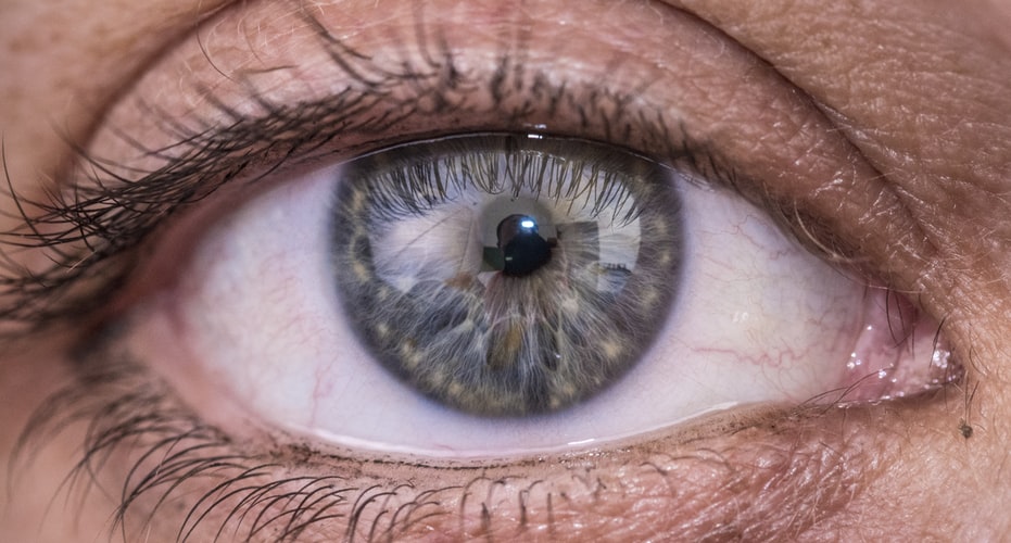 Ten Questions to Ask Your Optometrist about Scleral Lenses
