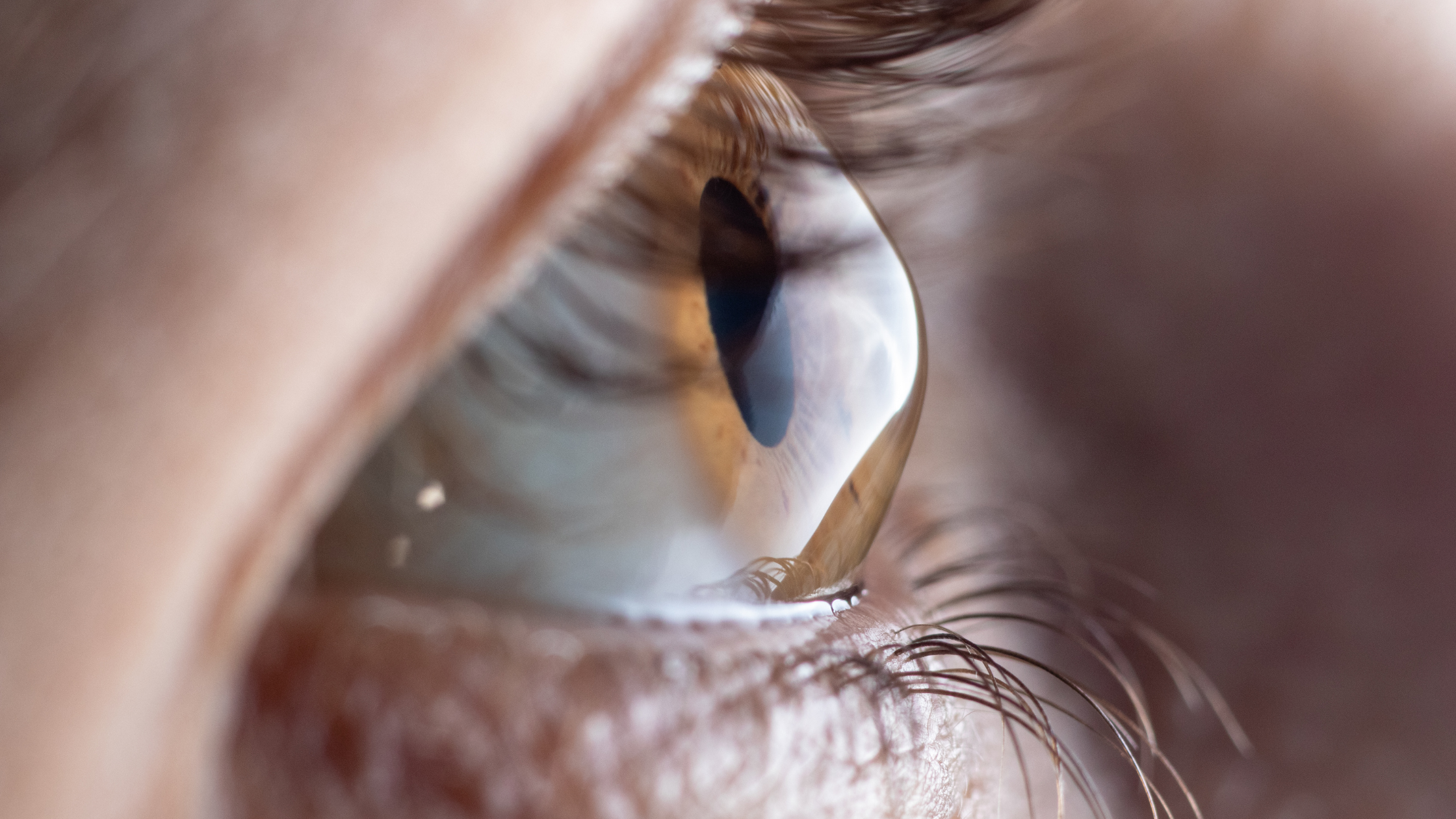 3 Warning Signs of Keratoconus