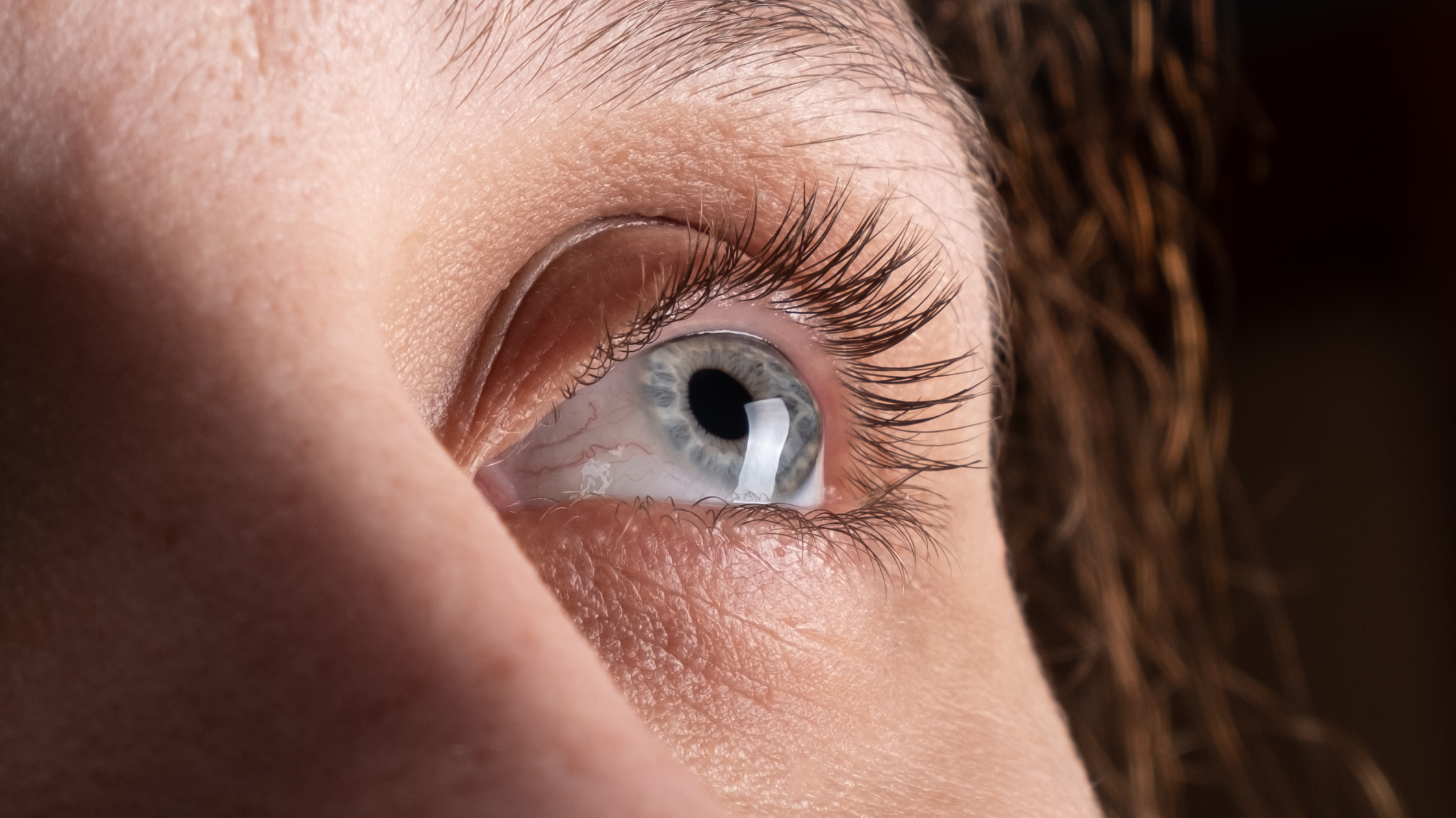 Keratoconus Treatment Options: What You Need to Know