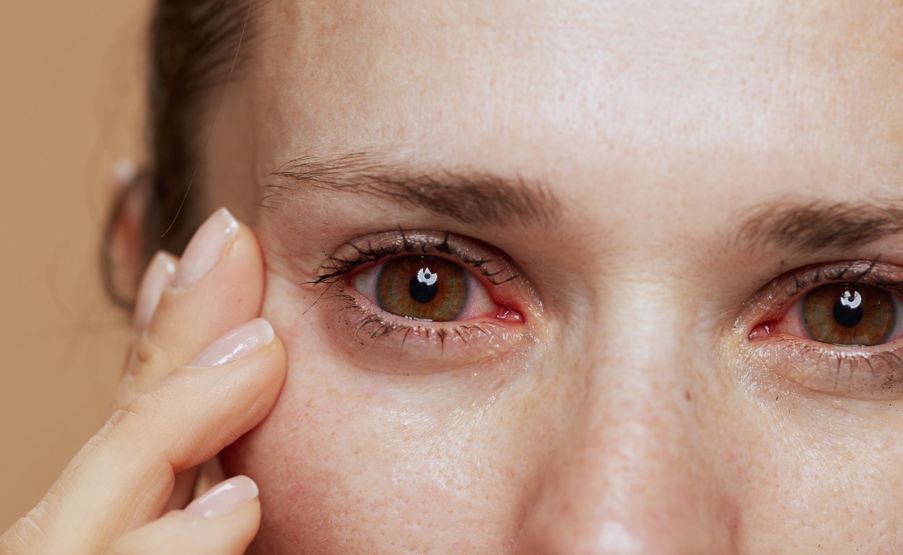 Overcoming Chronic Dry Eye with Customized Treatment Plans