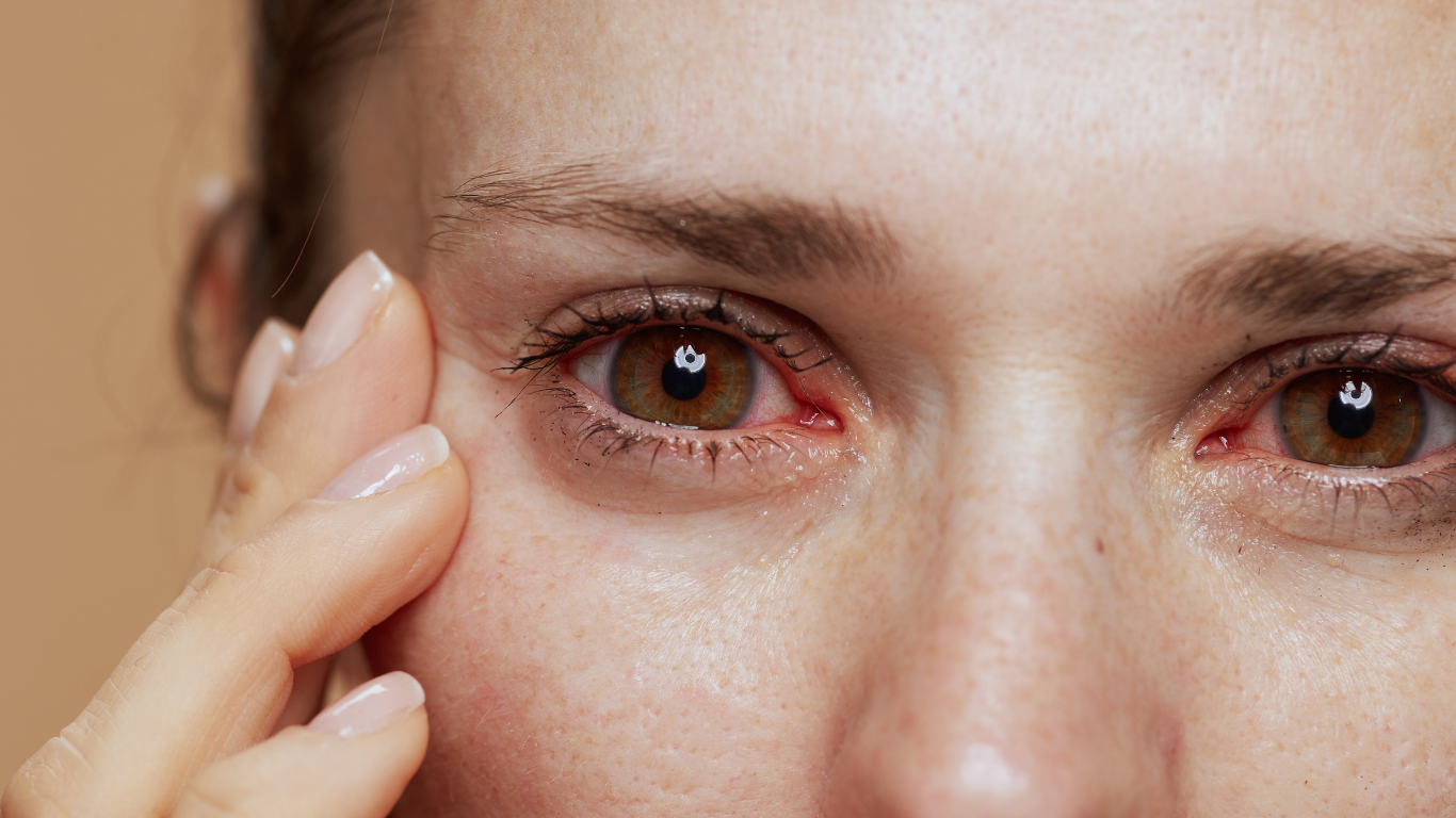 Do Scleral Lenses for Autoimmune Eye Disorders Work? 