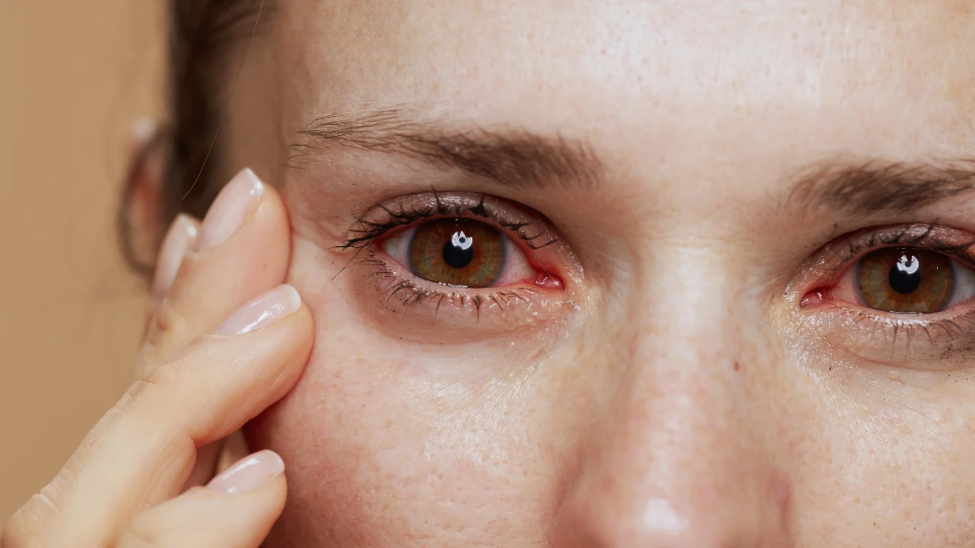 Do Scleral Lenses for Autoimmune Eye Disorders Work?