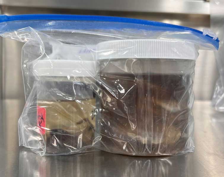 Formalin jars containing preserved poultry tissue samples