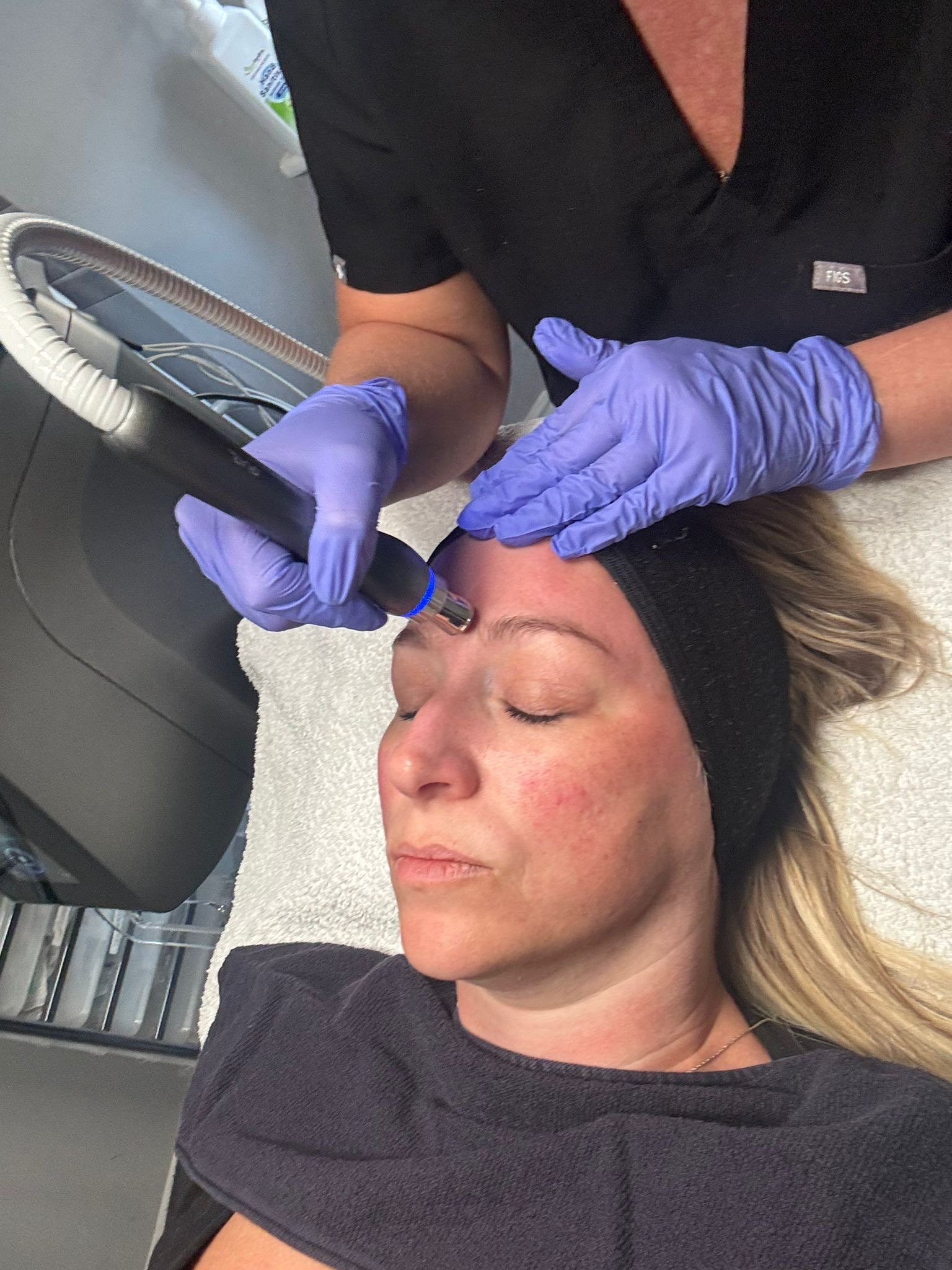 image of acupuncture session
