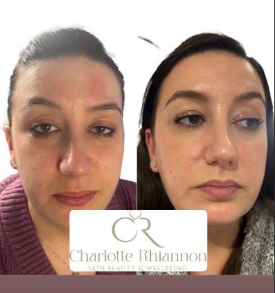 image of pharmacy community engagement activities