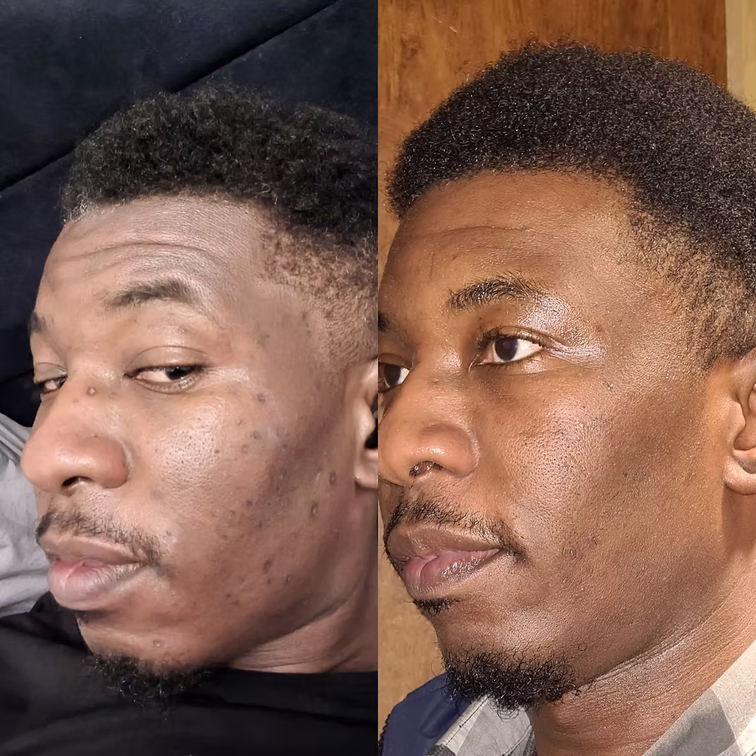 outdoor yoga session in a tranquil garden