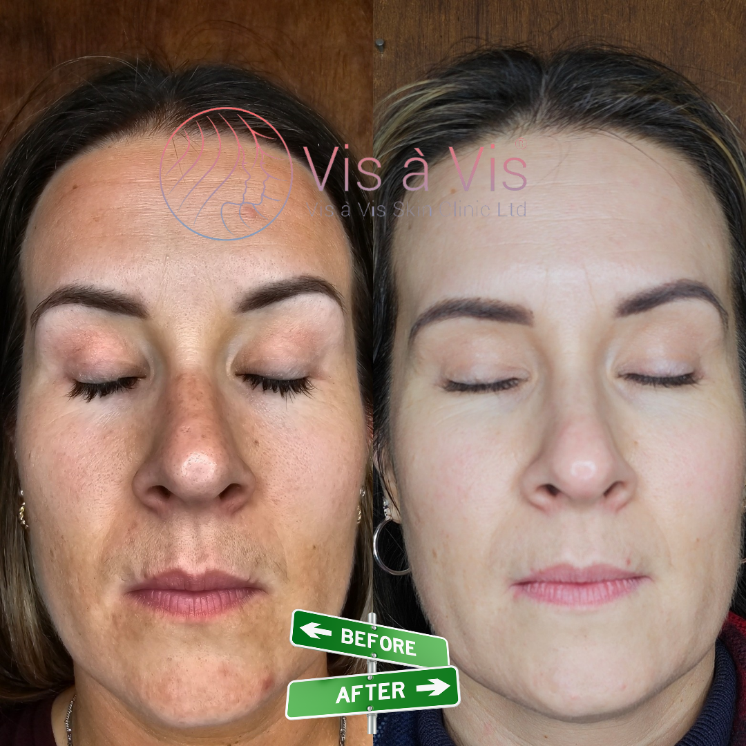 Skin care Bedfordshire