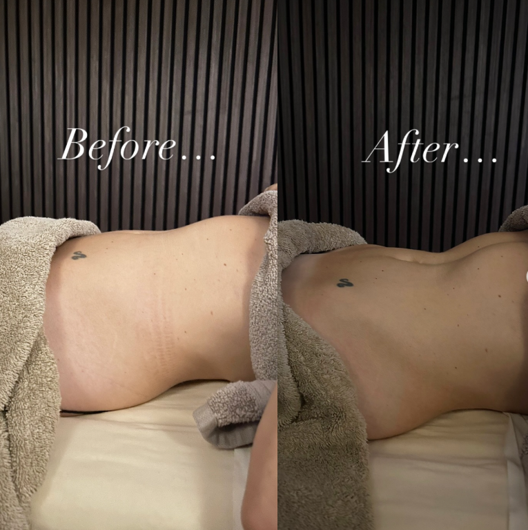 outdoor yoga session in a tranquil garden