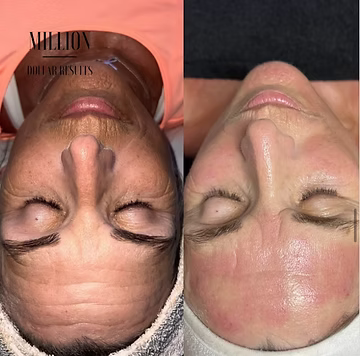 outdoor yoga session in a tranquil garden