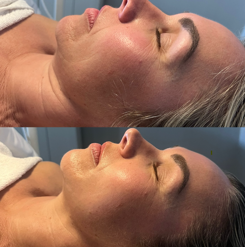 outdoor yoga session in a tranquil garden