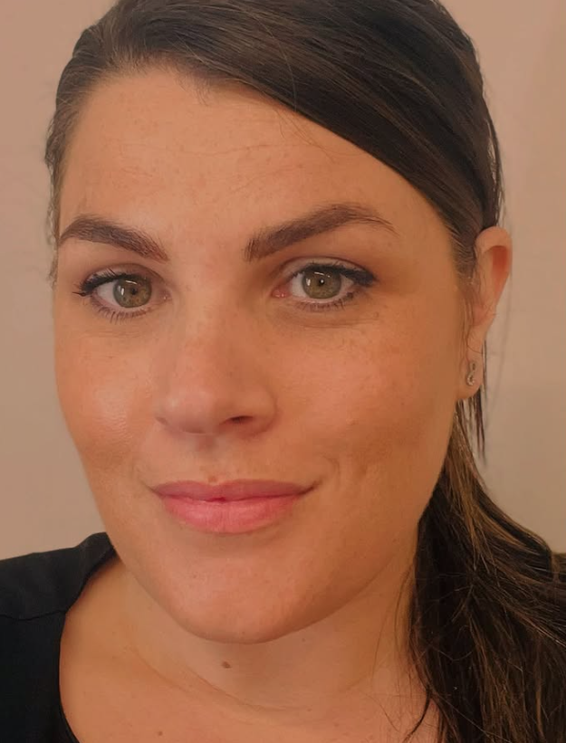 image of acupuncture session