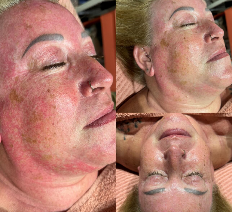 image of pharmacy community engagement activities