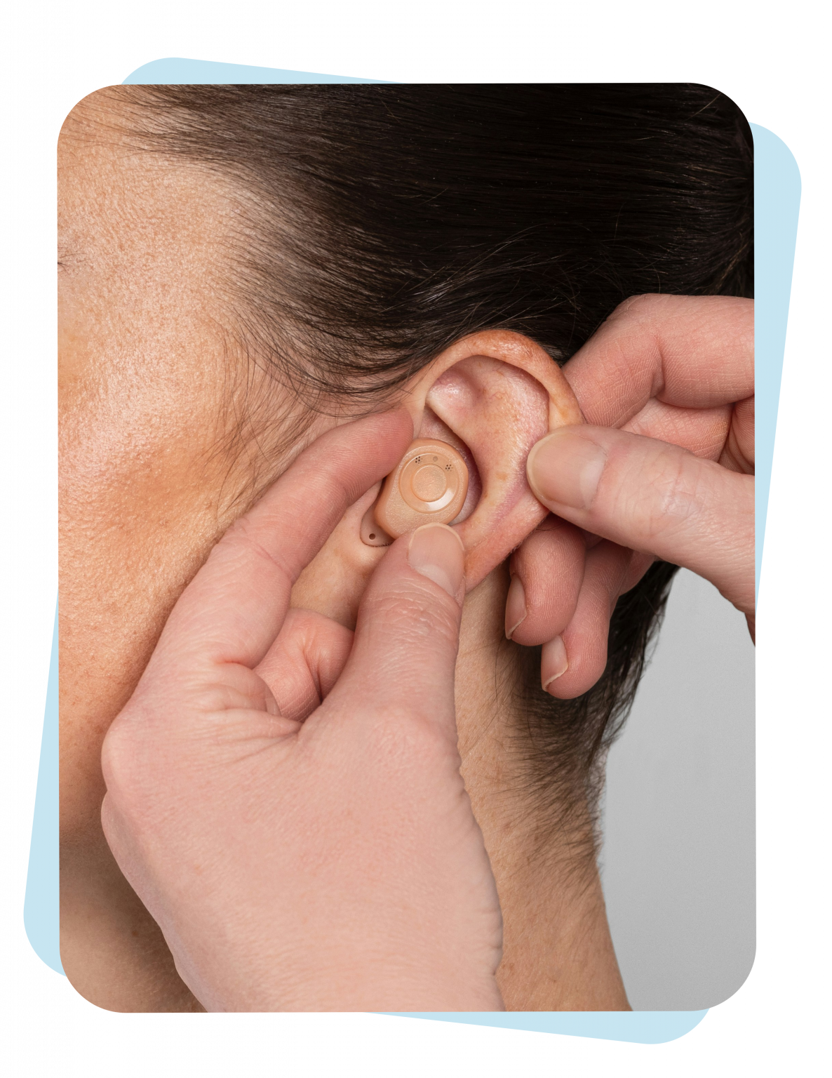 image of acupuncture session
