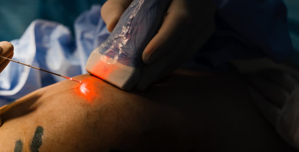 A person holding a medical device aimed at a patient's skin, emitting a red light, indicating a laser treatment.