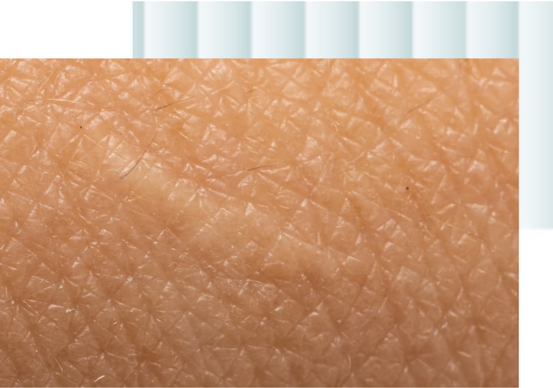 A close-up image of textured skin showing fine lines and bumps.