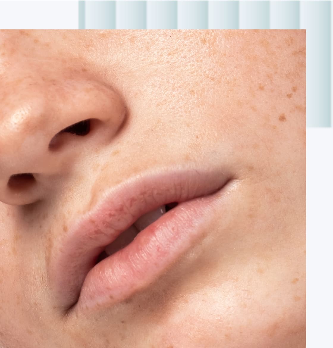 A close-up image of a person's face, focusing on the lips and nose, showing a natural skin texture with visible freckles.