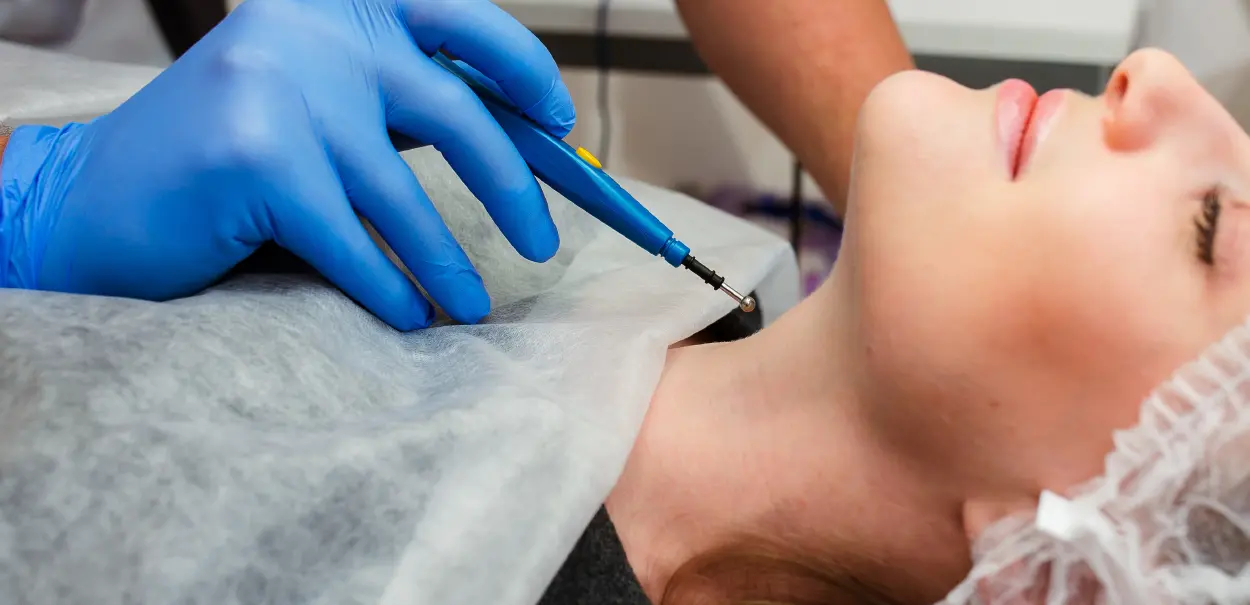 A person's hand wearing a blue glove is holding a small, handheld tattoo machine close to a client's neck. The client appears to be lying on a treatment table covered with a white paper sheet.