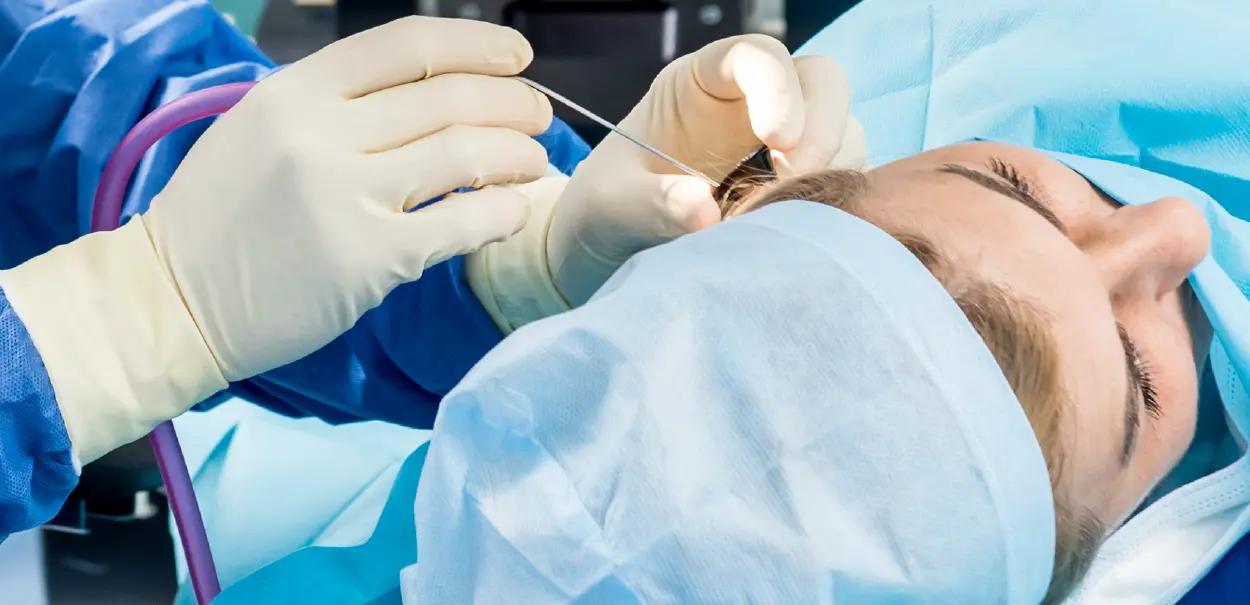A medical professional wearing gloves and surgical attire is performing a procedure on a patient lying on an operating table. The patient's head is covered with a blue surgical drape, and the professional is inserting a thin needle into the patient's.