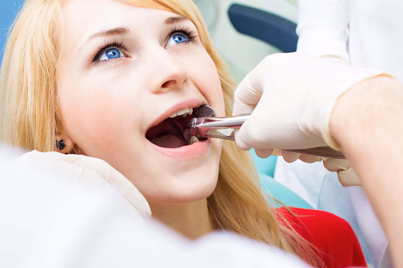 Wisdom Teeth Removal in Charleston, SC