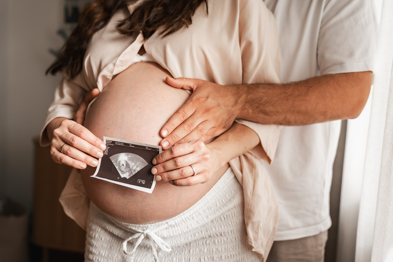 Schwangerschaftsfoto mit Ultraschallbild – Paar hält gemeinsam das Babyfoto vor den Bauch, emotionale und persönliche Babybauchfotografie