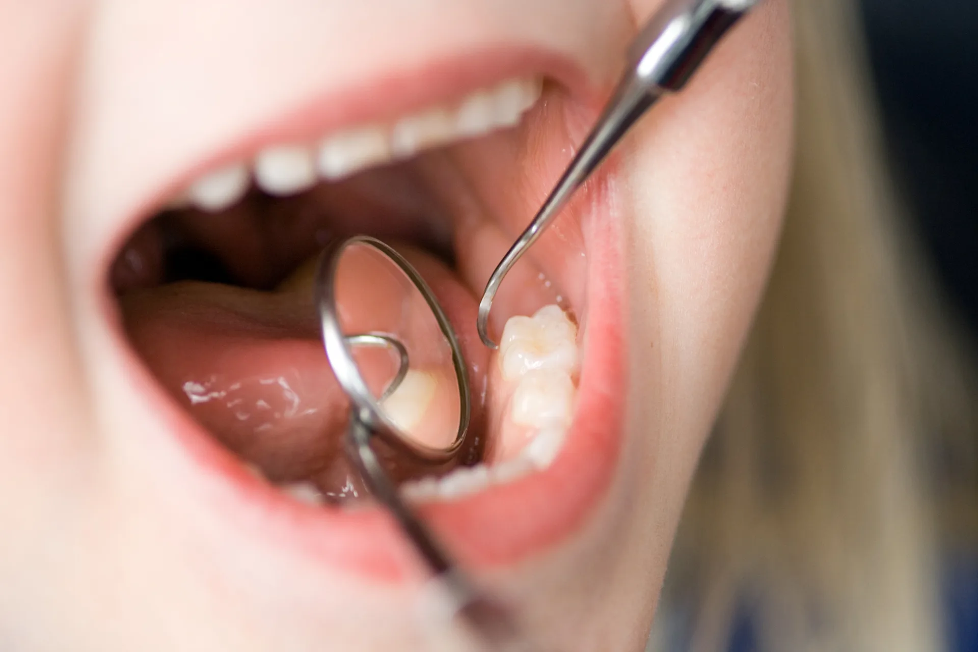 Pediatric Cleanings & Exams in Los Feliz | Griffith Pediatric Dentistry