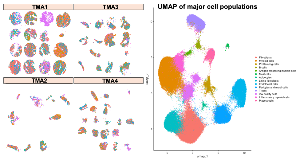 Four tissue microarrays colored by cell type and a UMAP showing 13 major cell populations