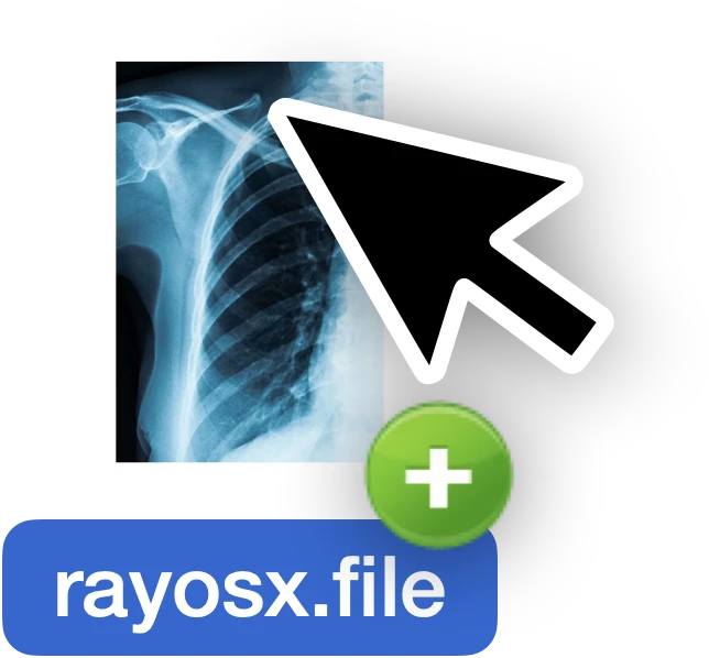 Archivo de rayos X