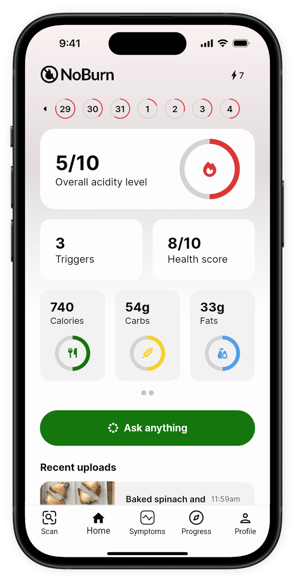 NoBurn: Reflux and GERD app home screen. Has acidity tracker, food scans, triggers, calories, and recent meal logs