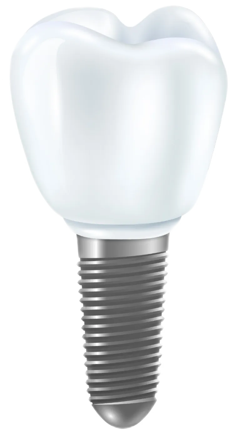 Dental crowns and bridges