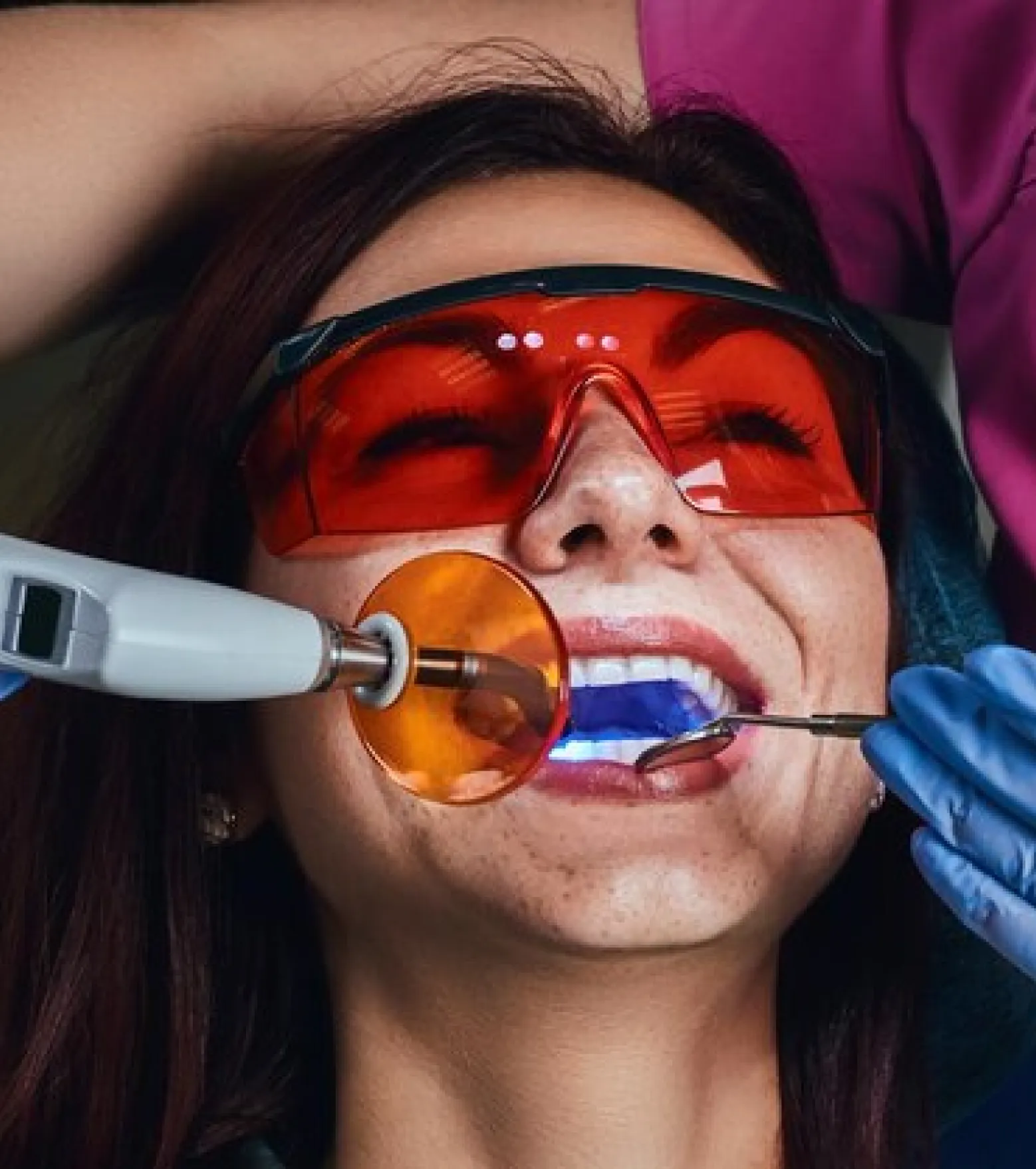 Woman wearing protective red glasses undergoing dental treatment with curing light and dental mirror.