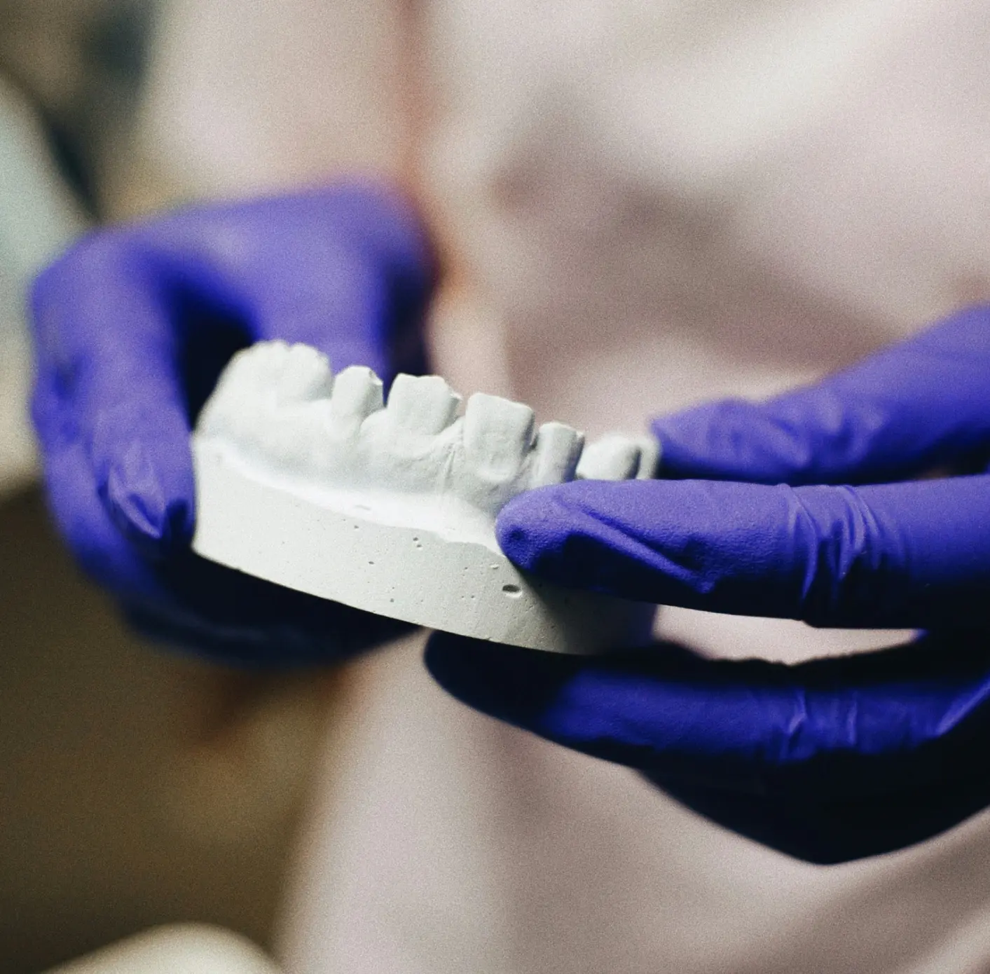 Hands wearing purple gloves holding a white dental mold of teeth.