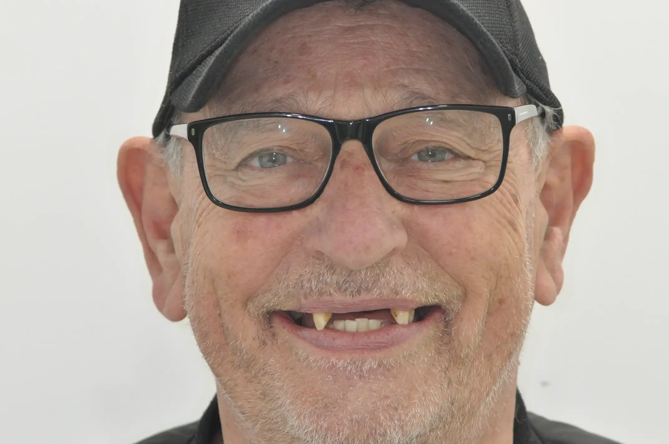 Smiling elderly man wearing black glasses and a black cap, showing two pointed upper canine teeth.
