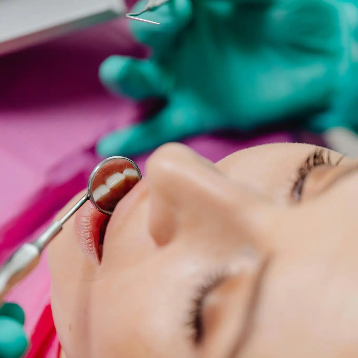 Close-up of a dental mirror reflecting teeth inside a patient's open mouth during a dental exam.